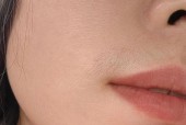 女生有胡子怎么办（探讨女性多毛症的成因和解决方法）