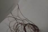 如何应对头发掉得很厉害（15种有效方法让你告别掉发烦恼）