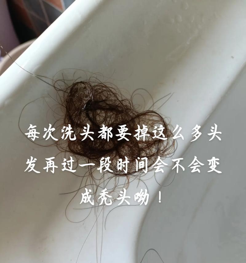 如何应对头发掉得很厉害（15种有效方法让你告别掉发烦恼）  第2张