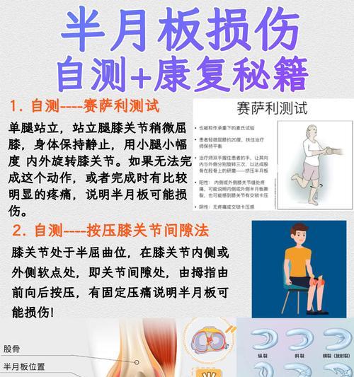 半月板损伤的治疗与恢复（如何有效地治疗半月板损伤并促进康复）  第3张